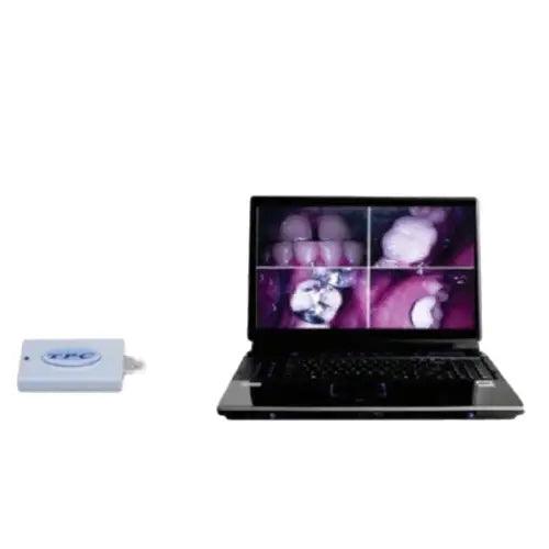 TPC Advance Cam Intraoral Cordless USB Camera System Wl-USBCAM-Pkg Intraoral Cordless USB Camera 