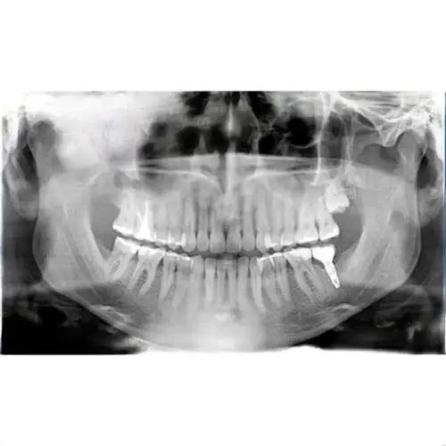 New 2D Owandy I-MAX Wall Mounted Panoramic X-ray 9304000011 Panoramic 2d-owandy-i-max-wall-mounted-panoramic-x-ray-9304000011 Dentamed USA 