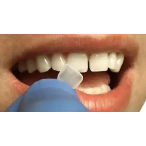 ProVeneer In-Office Veneer System – Silmet Dental 2198239 - DENTAMED USA